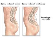 DesviosColuna3