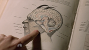 217 Ziegevolk Brain